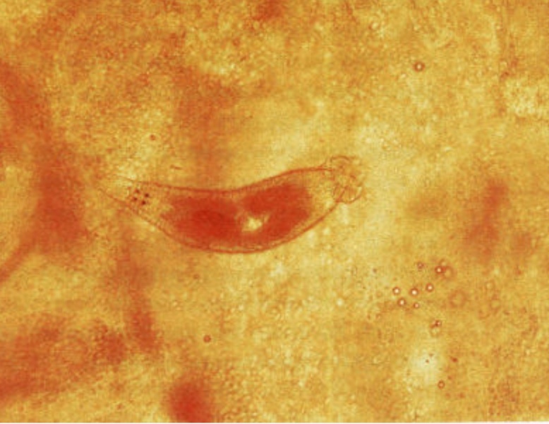 Fichier:Kc dactylogyrus.jpg